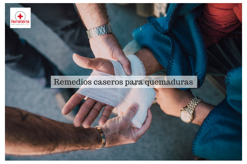 Estos son los mejores remedios caseros para quemaduras